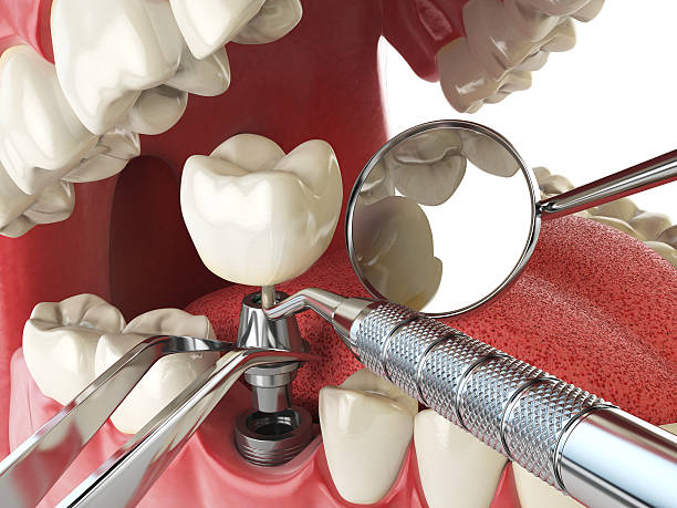 Best Emergency Dental Care for Trauma or Injury in Willow Grove, TX